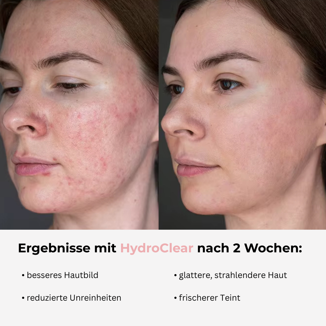 HydroClear - Dein Nr. 1 Wasserfilter